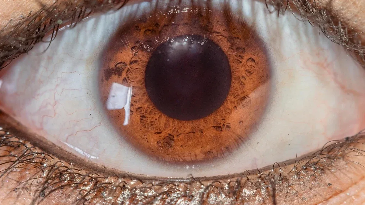 Fovea e macula: qual è la differenza tra queste due aree della retina?